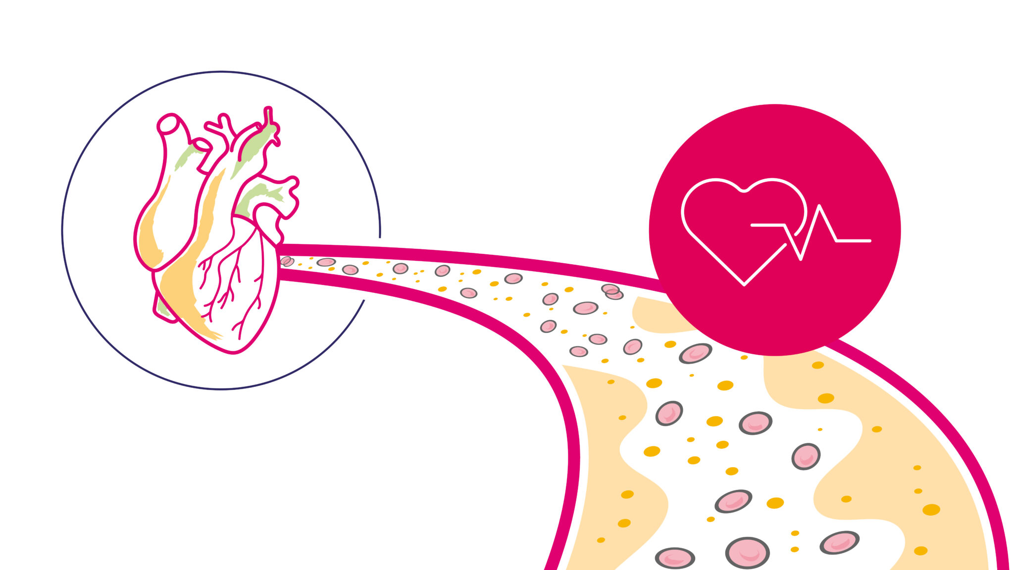 2026004_Uitgelichtlichte_afbeelding_DS